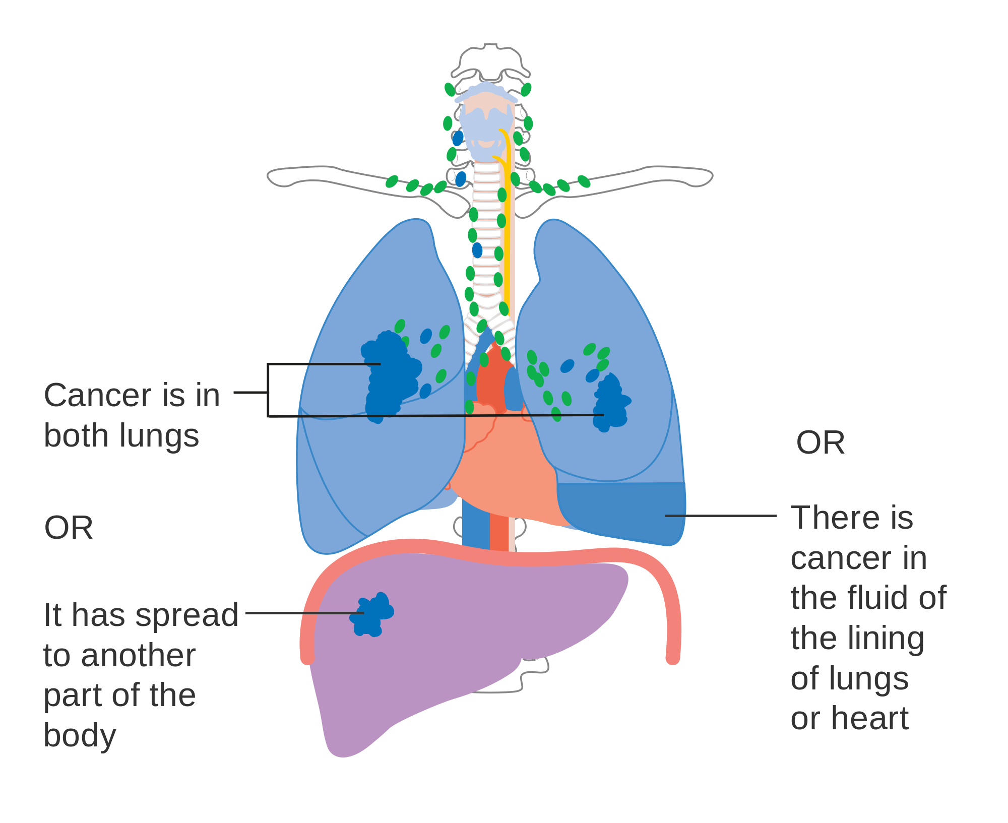 Robotic Heart Surgery